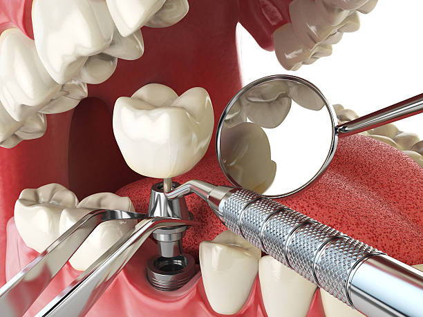 Best Emergency Root Canal Therapy in Grandwood Park, IL